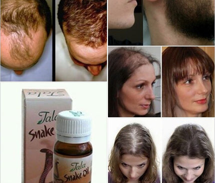 Tala Snake Oil 20Cc - REMOVES HAIR WITH SNAKE OIL FORMULA - 100% NATURAL FORMULA